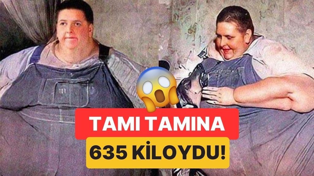 Dünyanın En Kilolu İnsanı Jon Brower Minnoch