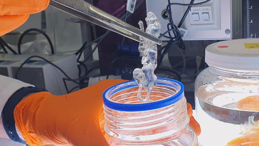 Türk profesörden ses getiren araştırma: Covid-19 kafatasında bekleyip beyne sinsice sızıyor! Hastalık atlatılsa bile yıllarca kalıyor ‘Pandemiden daha etkili’