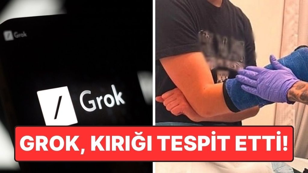 X’in Yapay Zekası Grok Doktorların Gözden Kaçırdığı Kırığı Tespit Etti