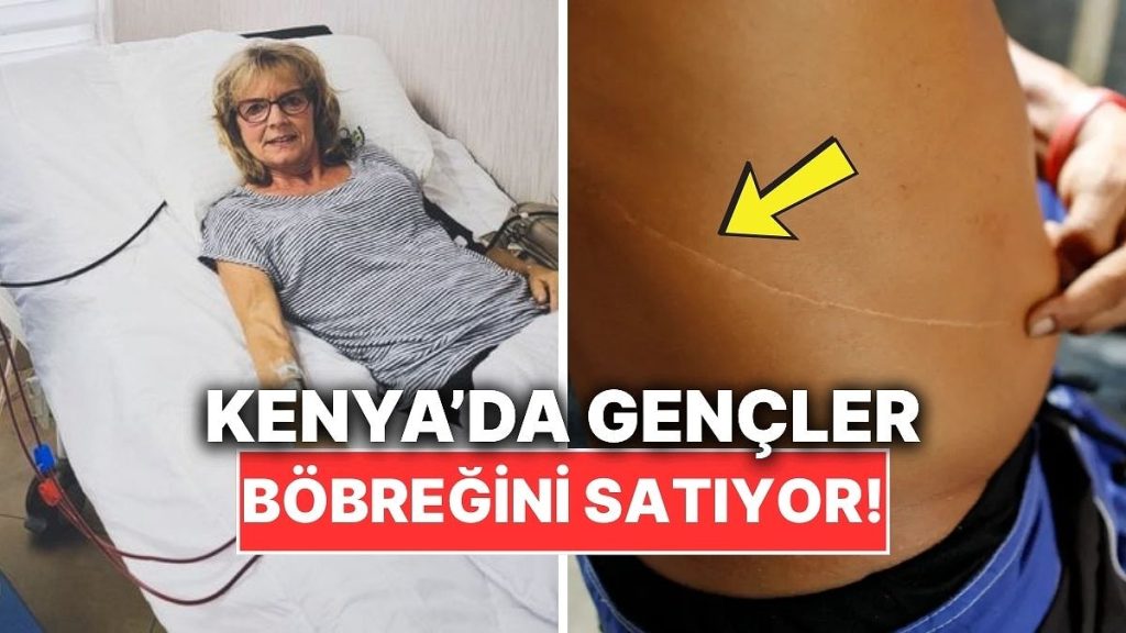 Kenya’dan Böbrek Satın Alınabiliyor – Onedio