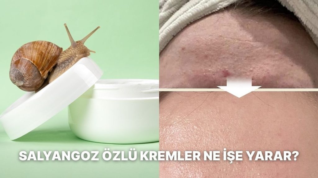 Son Dönemde Popüler Olan Salyangoz Özü Nedir, Kremi Ne İşe Yarar?