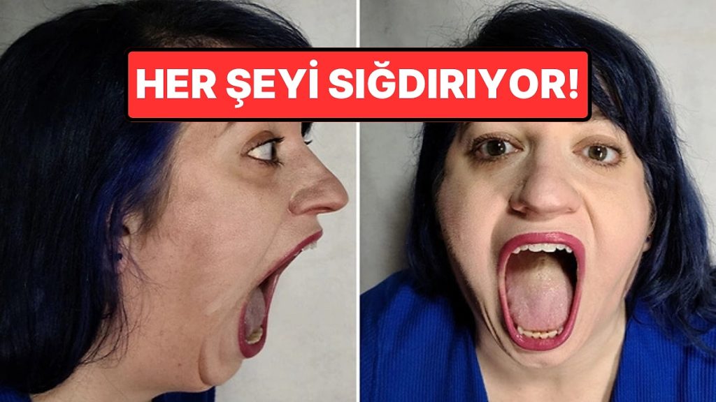 Dünyanın En Geniş Ağzına Sahip Kadını
