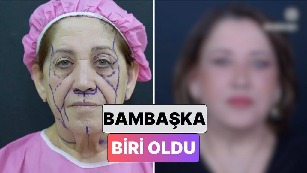 ESTETİKLE BAMBAŞKA BİRİNE DÖNÜŞTÜ – Onedio