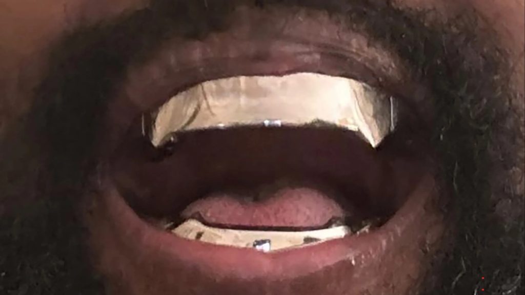 Kanye West, eski dişçisi Thomas Connelly’ye dava açtı