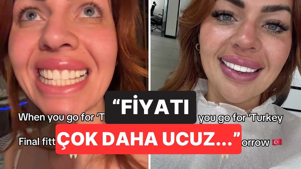 Türkiye’de Diş Estetiği Yaptıran Kadın Gündem Oldu